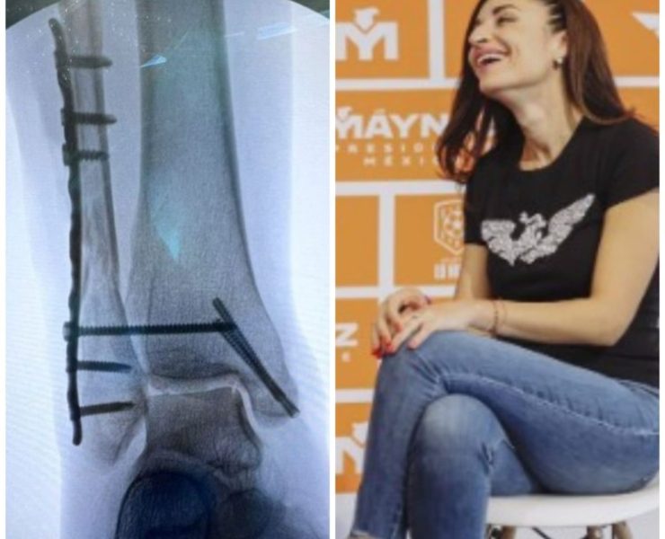 Ballersteros se recupera tras despome de templete en San Pédro